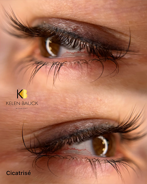 Dermopigmentation 3