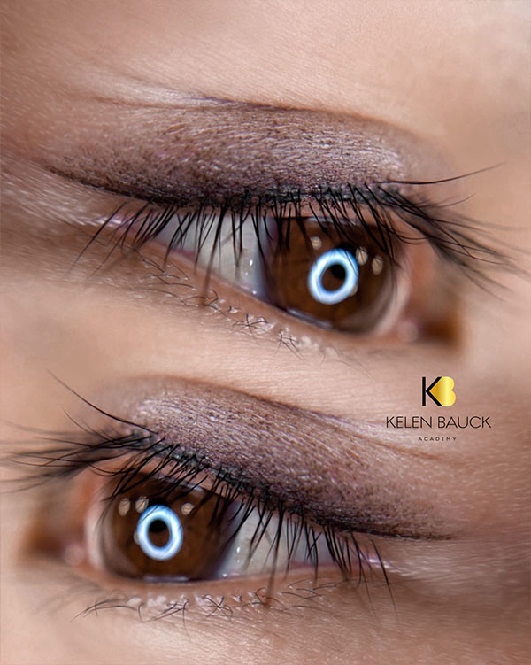 Dermopigmentation 6