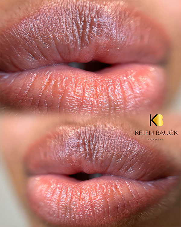 Dermopigmentation