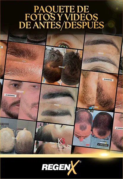 15 - Paquete de fotos y videos de antesdespués