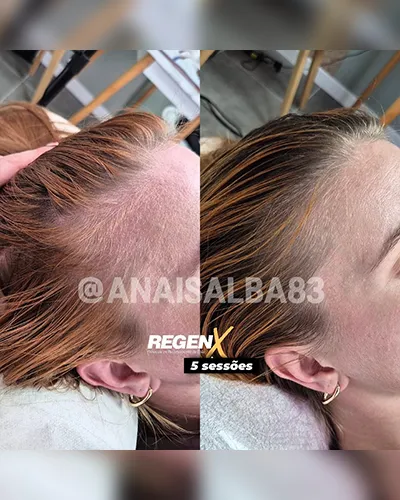 Anais Alba @anaisalba83 - cabelo a2 - 5 sessões