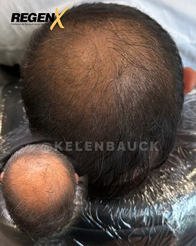 CABELO PT - KELEN BAUCK