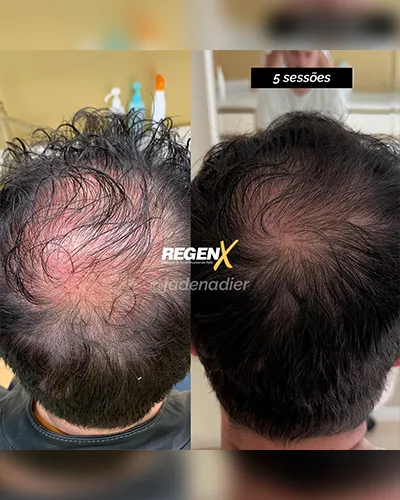 Jade Nadier - CABELO Ab - 05-07-2025 PT