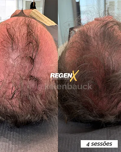 Kelen Bauck - Cabelo B 25-06-2025 PT