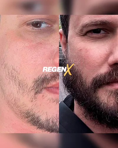OUT-2025-ROBERTO---4-SESSÕES