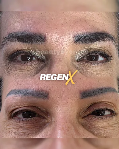 Sobrancelha-01---@beautybyorane---X-sessões