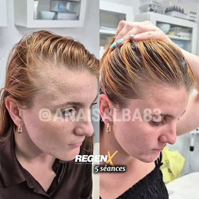 Anais Alba @anaisalba83 - cabelo a1 - 5 sessões