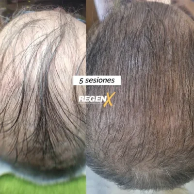 Cathy - cabelo A 18-06-2025 ESP