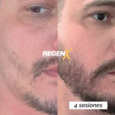 JUL 2025 ROBERTO - 4 SESSÕES ESP
