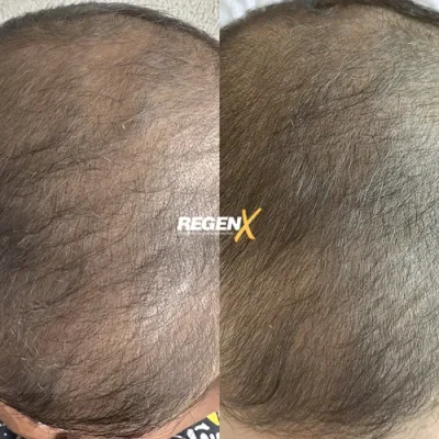 Jessie Bauck - Cabelo A 18-06-2025