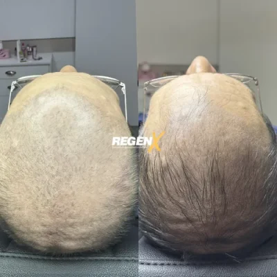 Jessie Bauck - Cabelo C 18-06-2025