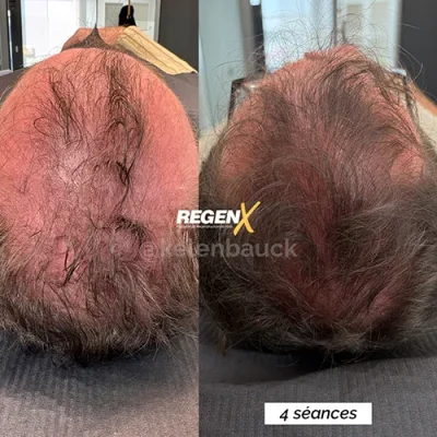 Kelen Bauck - Cabelo B 25-06-2025 FR