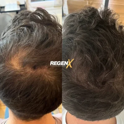 Louise Geertsen - Cabelo B 18-06-2025