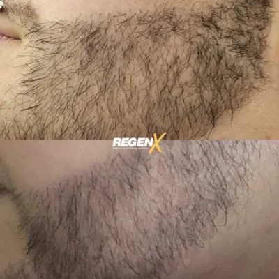 Orane Ixe - Barba A 18-06-2025