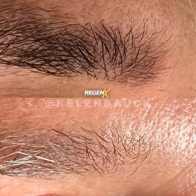 REGENX SOBRANCELHA KELEN 2