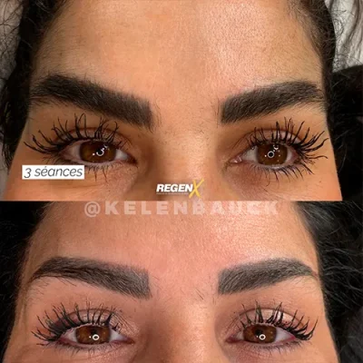 REGENX SOBRANCELHA KELEN 9