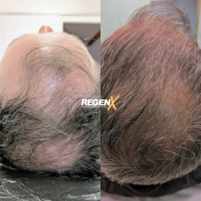 Sophie C - Cabelo A 18-06-2025