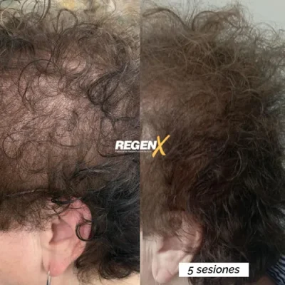Stephanie Bailly - Cabelo B 18-06-2025 ESP